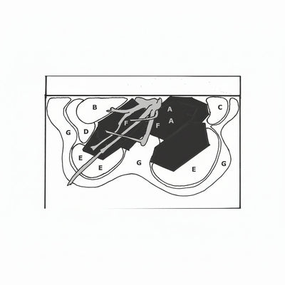 Layout 63 (100 L) 13 Pflanzen